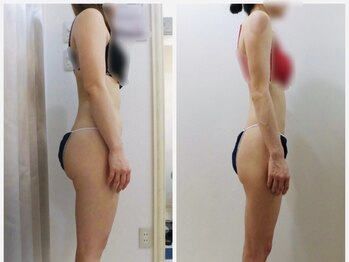 アイディエム 新宿店(IDM)/【モニター】156ｃｍ・20代