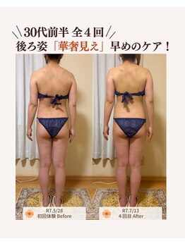 ユナリ(yunari)/30代前半｜Before・Afte