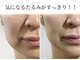 サロンドボーテ ベル(SALONDEBEAUTE BELLE)の写真/気になるほうれい線たるみは脂肪分解/毒流しリンパですっきり◎リフトアップ小顔◎見た目年齢は変えられる