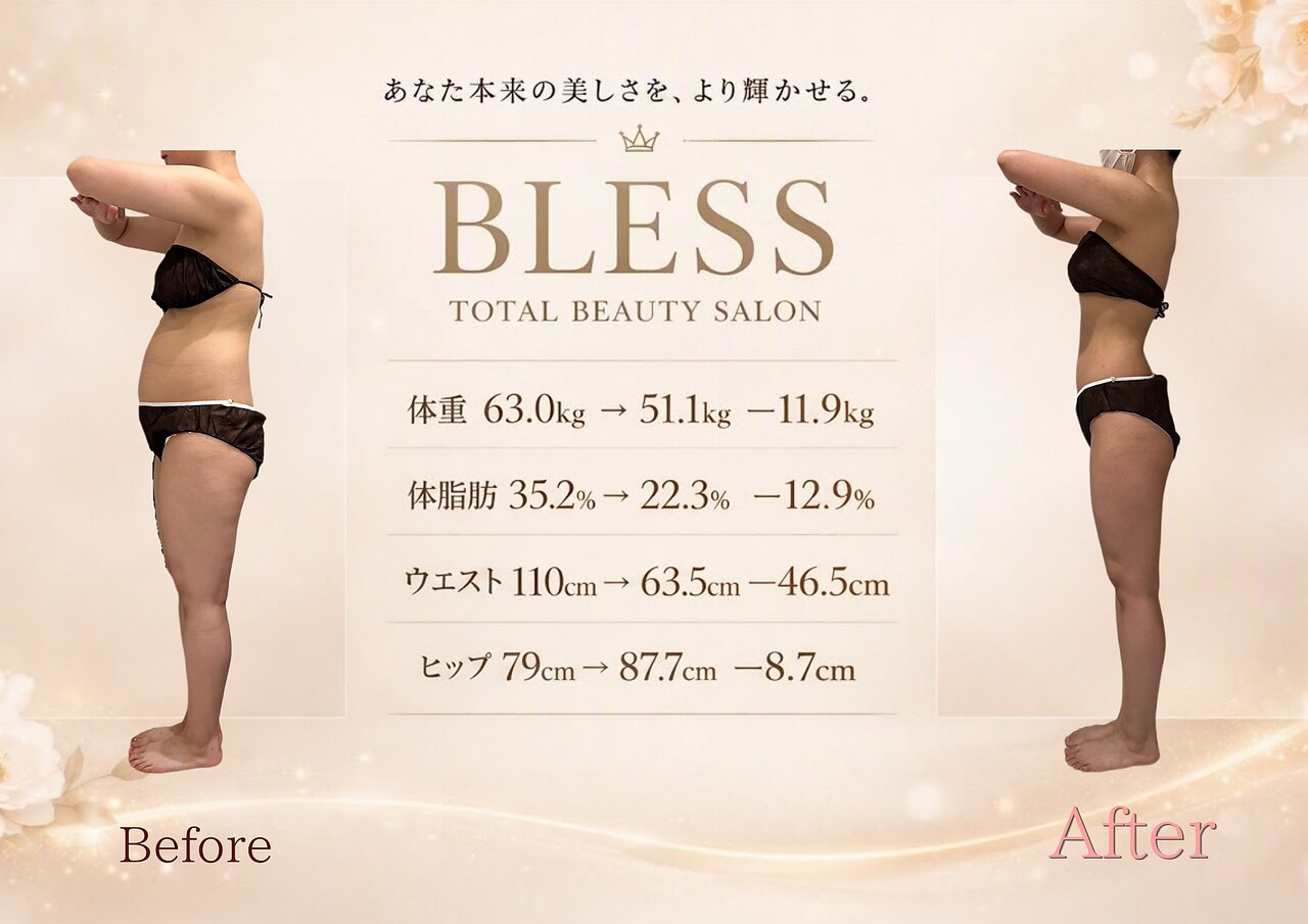 エステサロン ブレス 山形店(BLESS)｜ホットペッパービューティー