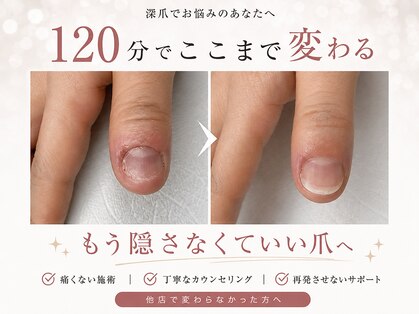 アウェイク(Awake)の写真
