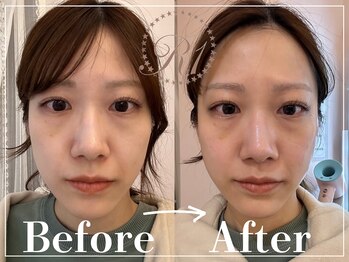 R-1ビューティーサロン 表参道/Before&After