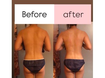 南国 蒼 越谷(ao)/シンメトリー矯正