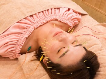 ネテマテ 表参道(netemate)の写真/【小顔特化】二重あご・たるみ改善・ほうれい線などお顔のお悩みは当店にお任せ！リンパ&美容鍼で速攻小顔!
