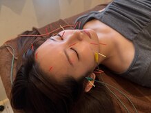 ひかり鍼灸整骨院 南草津の雰囲気（美容鍼灸師による本格的な美容鍼が受けれる！）