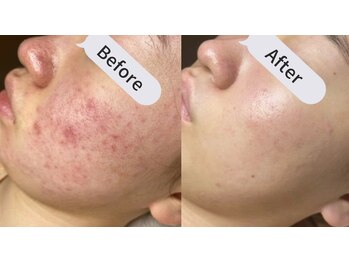 ジナ ビューティ(GINA BEAUTY)