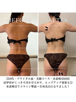 ヨサパーク モコ 蔵前(YOSA PARK moco)/短期間で集中ダイエット!