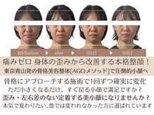 スフレ(souffle)の雰囲気（お顔の間伸び・左右差改善、歪みに特化した骨格調整で根本改善）