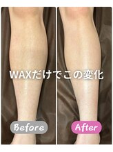 ジョエルワックス 沖縄那覇店(JOELLE WAX)/Lパーツ（両脚）WAX脱毛のみ！