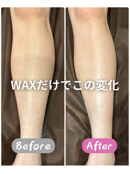 ジョエルワックス 沖縄那覇店(JOELLE WAX)/Lパーツ（両脚）WAX脱毛のみ！