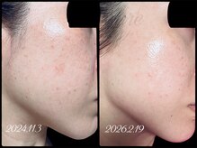 エルール トータルビューティ(Aileure total beauty)の雰囲気（肌質改善VOSサロンケア　ニキビ、シミ、毛穴短期集中ケア）