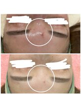 クラティス(CRATIS)/【レチノール】肌質改善艶肌へ