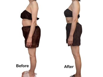 アロマテラピー 古香/話題のボディマシンでスッキリ