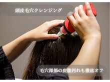 アニュー 大宮本店(ANEW)/頭皮クレンジングで毛穴もつるん