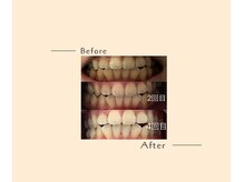 オベリオ(OBERIO)/