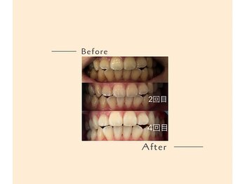 オベリオ(OBERIO)/