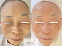 サラシック(salachic)/