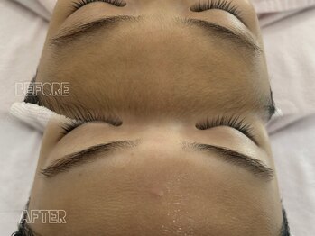 クイーン 渋谷店(QUEEN)/細かな産毛と一緒に角質も