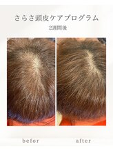 ナチュラル ビューティー スタイル さらさ(Natural Beauty Style)/頭皮のお悩みに◎