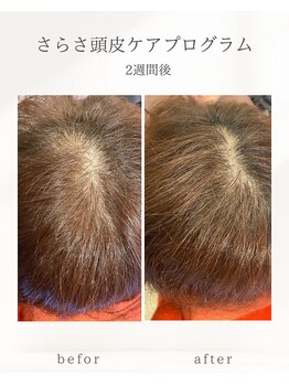 ナチュラル ビューティー スタイル さらさ(Natural Beauty Style)/頭皮のお悩みに◎
