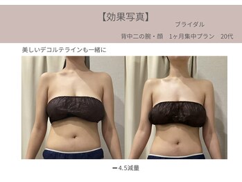 ミライ 福岡筑紫野店(mirai)/ブライダルメニュー4回コース