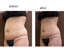 ウィズマツオカ 光の森店/ぽっこりお腹も撃退！