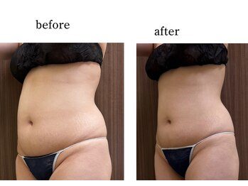 ウィズマツオカ 光の森店/ぽっこりお腹も撃退！