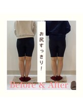 スタイルラボ高松/産後の骨盤矯正の効果♪