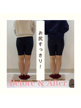 スタイルラボ高松/産後の骨盤矯正の効果♪