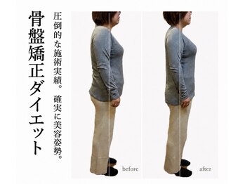 練馬アカデミア美容整体院の写真/マンジャロに頼らず健康的にキレイ痩せ♪美容姿勢矯正×骨盤矯正×ダイエット美容整体でよりスタイリッシュ