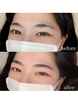 ダリ(Dali)/ハリウッドブロウリフト×顔脱毛