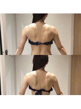 銀座レイア/ブライダル☆背中二の腕引き締め