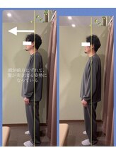 アイリー(Irie)/骨格矯正