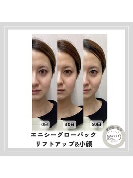 カラー(CALLA)/エニシーグローパック