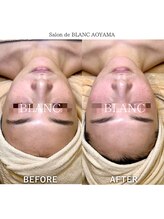 サロン ド ブラン アオヤマ(Salon de BLANC AOYAMA)/クリスティーナビオフィート