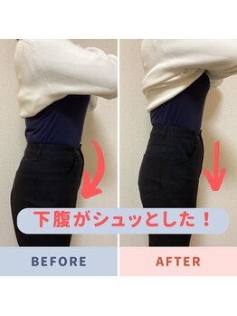 バンビ ビューティーラボ/下腹スッキリ