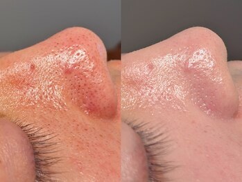 ルーナジェーナ(Luna llena)/池袋　エステ　ルーナジェーナ