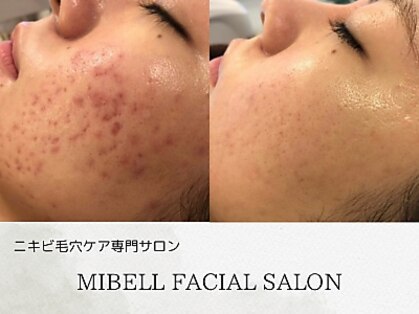 ミベル フェイシャルサロン(MIBELL FACIAL SALON)の写真