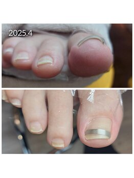 爪切り屋 足楽/