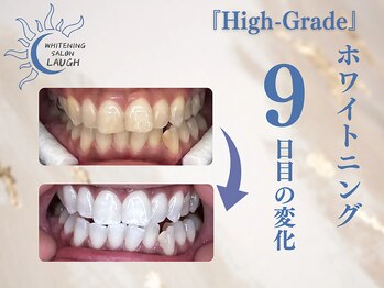 ラフ(LAUGH)/【審・美・白】 ホワイトニング