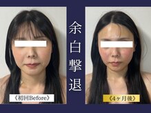 エレミュー 烏丸(Elemue.)/30代前半　8回　《エラ》