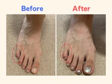 ピース/小指が寝ている30代女性