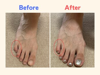 ピース/小指が寝ている30代女性