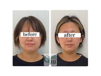 キュープ 北千住店(Qpu)/小顔頭蓋骨矯正.1