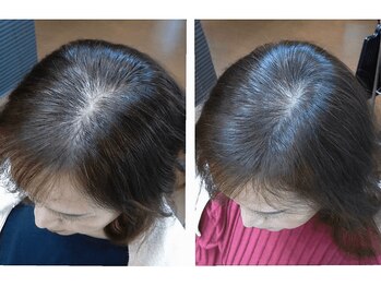 やなけん 亀戸店/頭皮が透けて見えるお悩みも◎