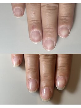 シー(sea)/自爪育成