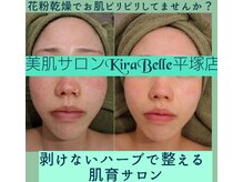 キラベル 平塚店(KiraBelle)