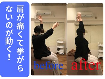 広島ミライエ整体院(広島MIRAIE整体院)/肩の動きが変わる