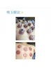 全身鍼灸＋吸い玉(カッピング)75分8000円→6000円！