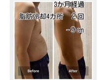 ラベージャ(La Bella)の雰囲気（《40代男性》2回で1サイズ↓ジム通いで落ちなかったお腹スッキリ）